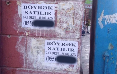 Bakıda açıq böyrək alveri - Foto